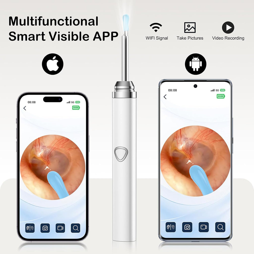 Ear Wax Removal Tool Camera，Wireless Ear Cleaner with Camera 1080P, Earwax Removal Kit with 6 LED Light 5 Replacement Ear Spoon, Ear Camera for iOS & Android (White)